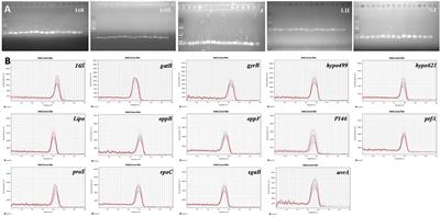 Selection of internal reference gene for normalization of reverse transcription-quantitative polymerase chain reaction analysis in Mycoplasma hyopneumoniae